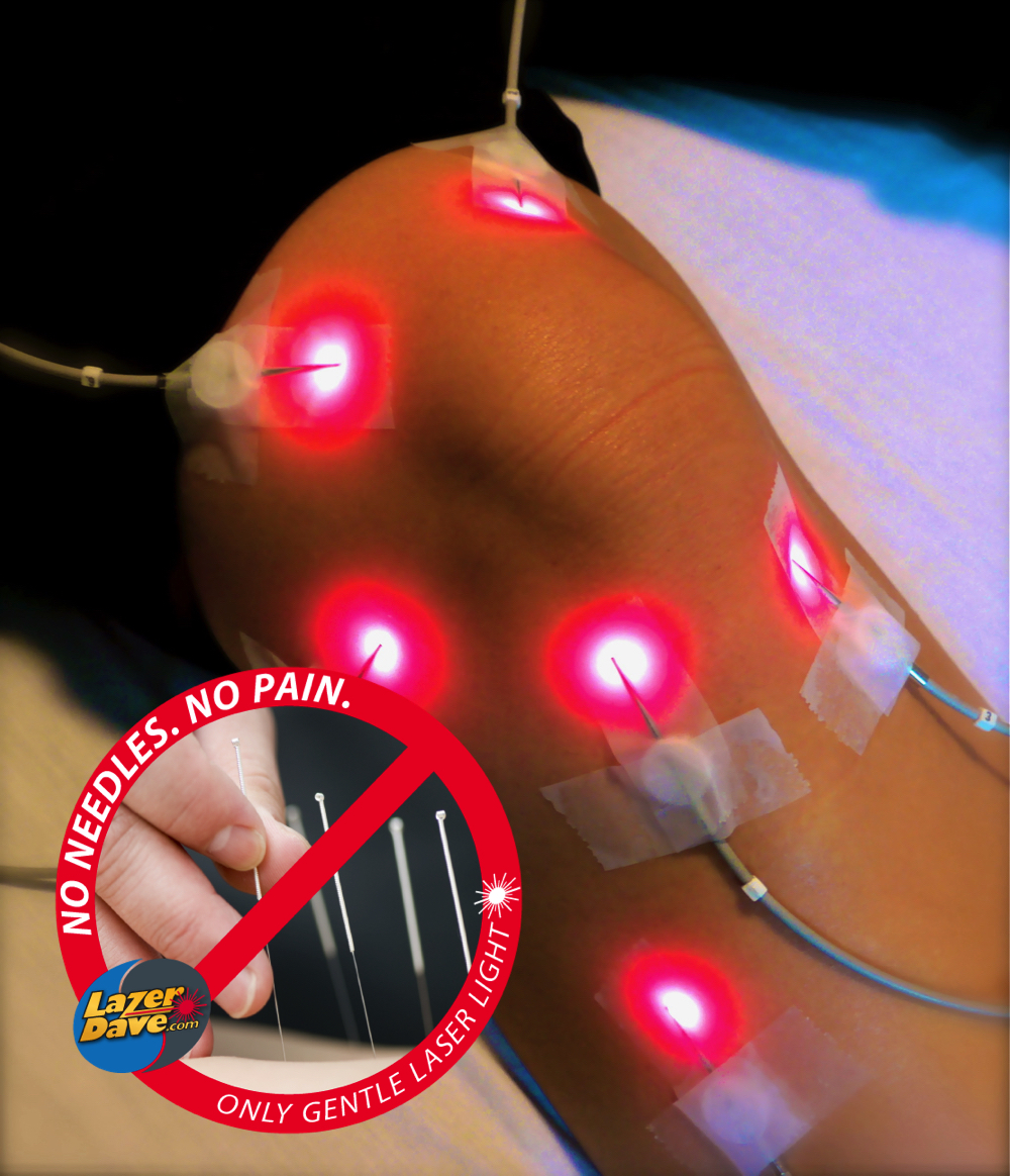 Is Laser Therapy Safe? Ottawa Laser Solutions
