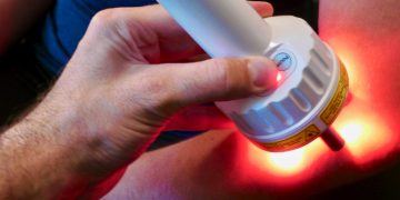 Laser Quit Smoking vs. Hypnosis: A Wellness-Based Comparison