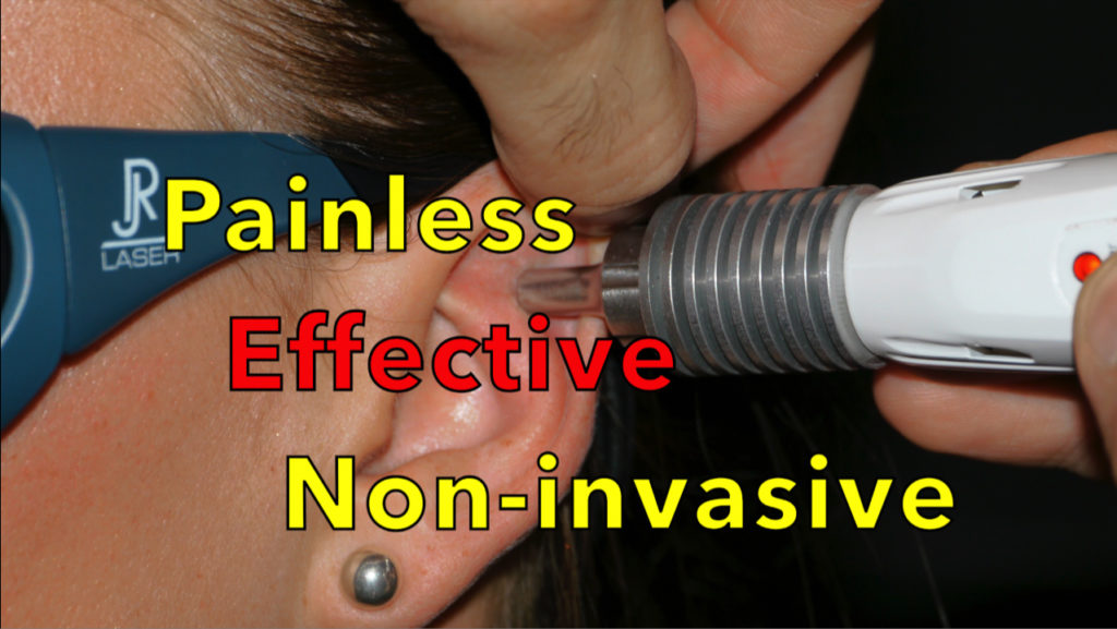 Laser therapy to quit smoking is painless, effective and non-invasive.