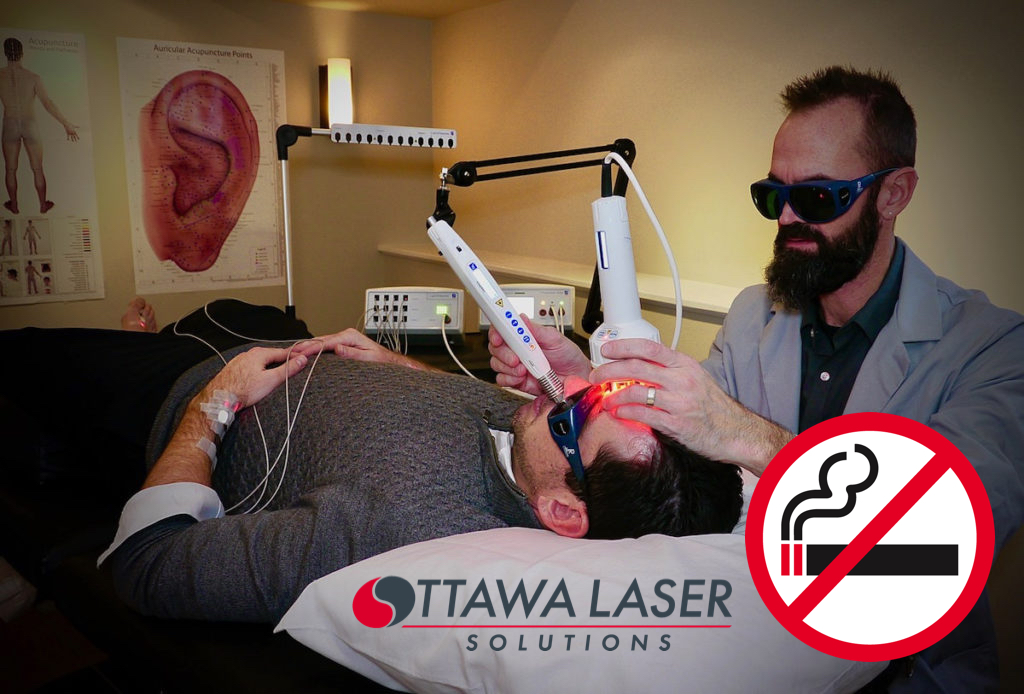 Lazer Dave, Certified Laser Therapist performing laser therapy to quit smoking.